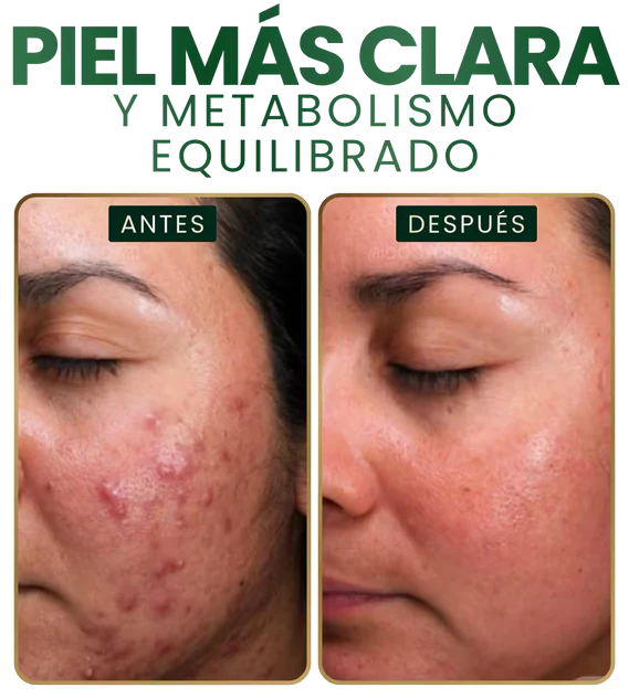 🌿LiverShield🇲🇽🫂   ❌$899   -✅$770